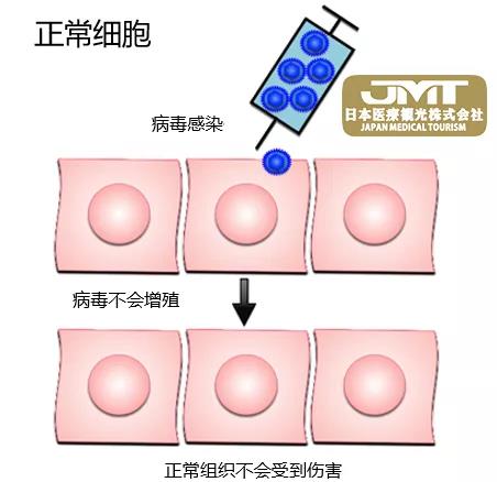 突破：世界上首个脑肿瘤病毒疗法在日本获批上市！