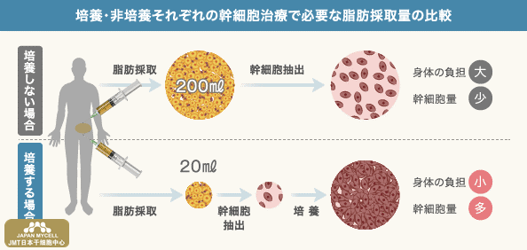 JMT日本干细胞中心-世界权威医学杂志刊登干细胞治疗研究论文（上）