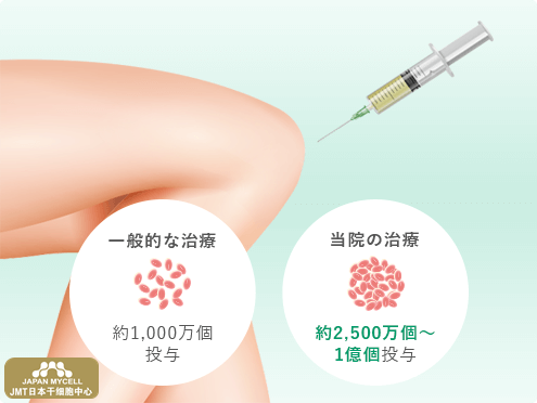 JMT日本干细胞中心-对半月板损伤、断裂的再生医疗、干细胞治疗（下）