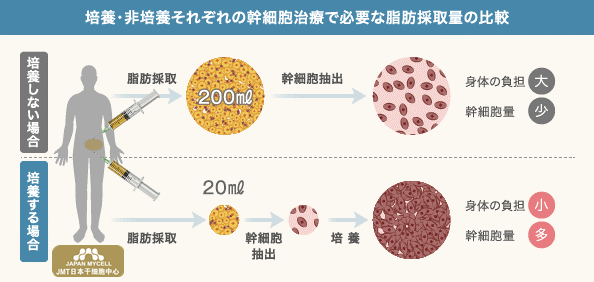 JMT日本干细胞中心-使用自己的细胞进行的膝盖的再生医疗