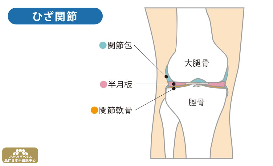 JMT日本干细胞中心-半月板损伤，只能通过手术才能恢复吗？