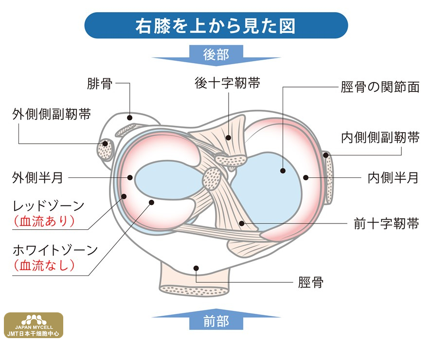 JMT日本干细胞中心-半月板损伤，只能通过手术才能恢复吗？