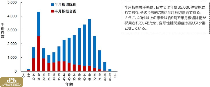 JMT日本干细胞中心-富士胶片与东京医科齿科大学以半月板损伤为对象签署关于全球首例自体间充质干细胞移植技术的专利授权协议