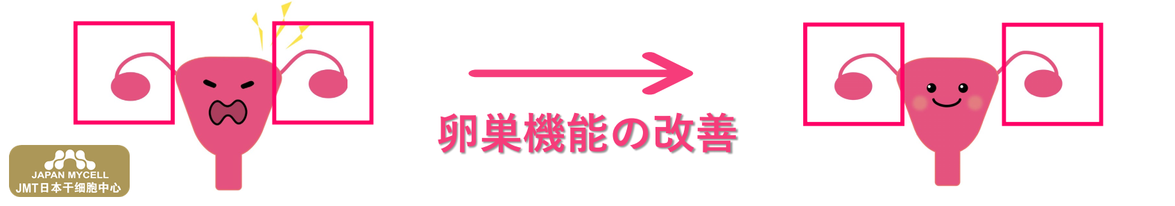 JMT日本干细胞中心-日本经血干细胞提升卵巢功能,促进卵子高质量 JMT日本干细胞中心-日本经血干细胞提升卵巢功能,促进卵子高质量