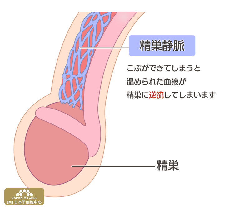 JMT日本干细胞中心-男性、女性的不孕症的原因和检查，日本干细胞治疗！