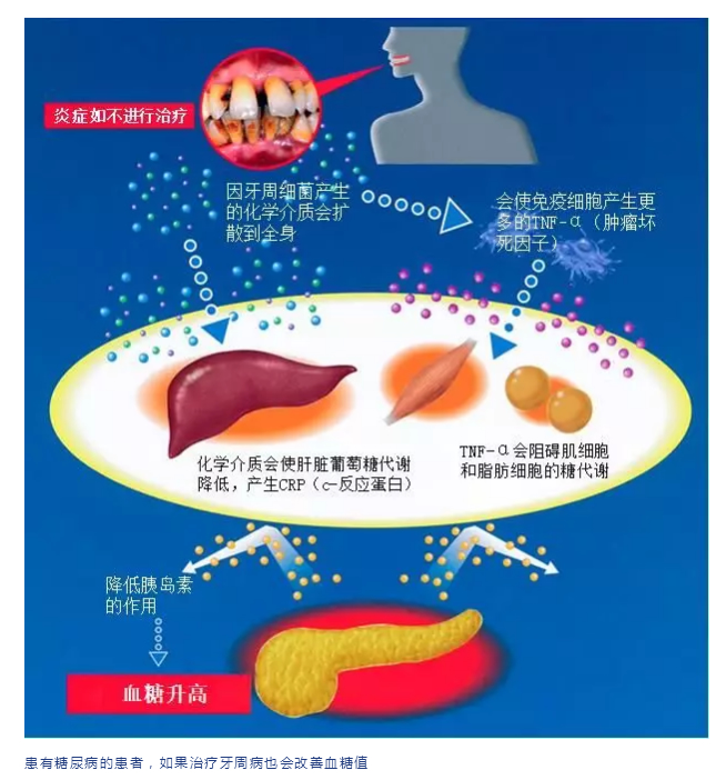 日本批准干细胞应用临床！间充质干细胞与牙周病的再生治疗