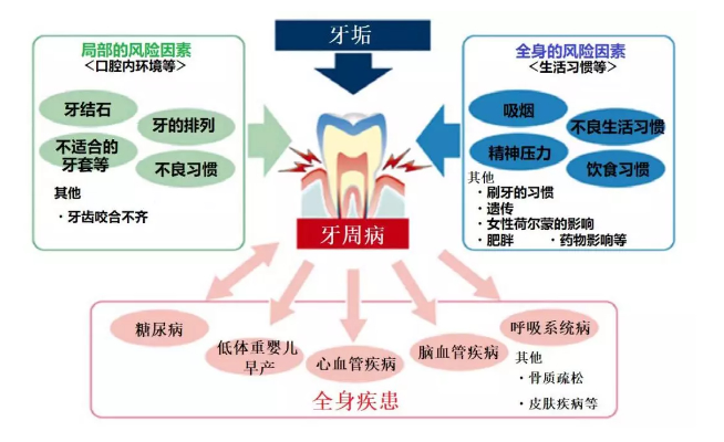 日本批准干细胞应用临床！间充质干细胞与牙周病的再生治疗