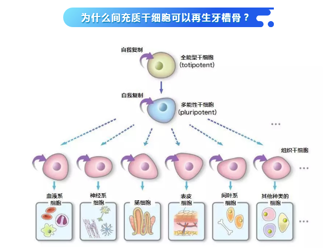 日本批准干细胞应用临床！间充质干细胞与牙周病的再生治疗