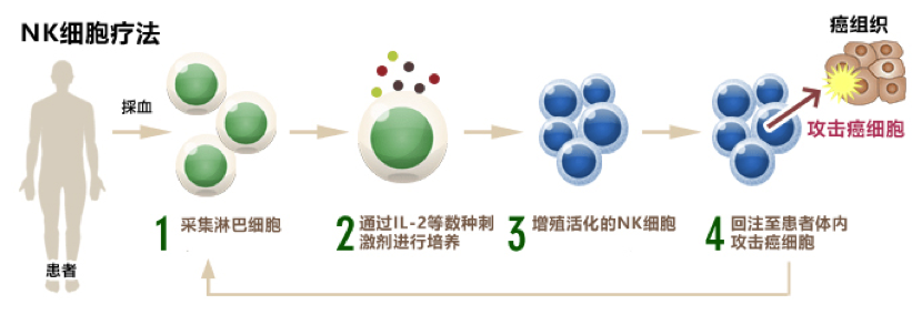 日本免疫细胞,细数日本免疫细胞疗法