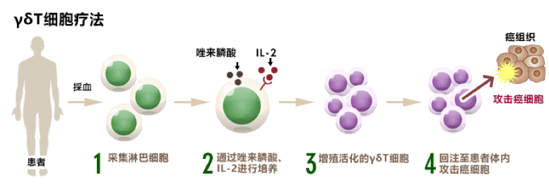 日本免疫细胞,细数日本免疫细胞疗法