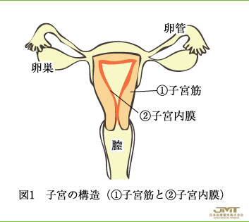 子宫内膜异位症及其症状（一）