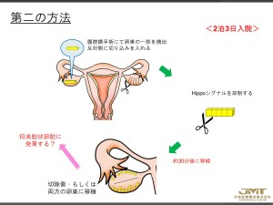 关于衰老卵巢的治疗