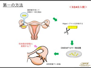 关于衰老卵巢的治疗