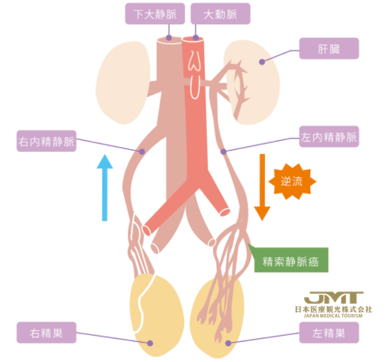 男性不孕不育的原因有哪些②