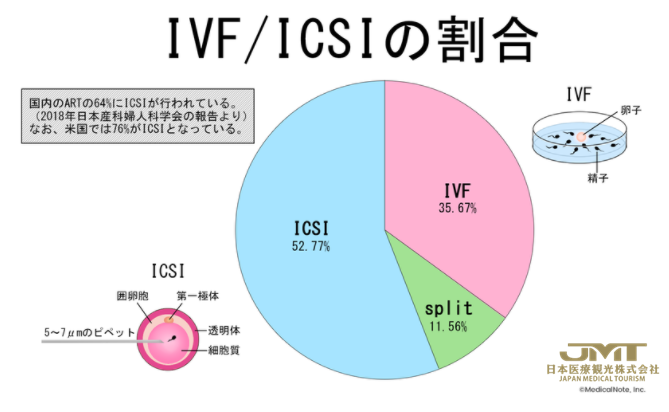 显微授精（ICSI）治疗不孕不育有哪些优势和风险？