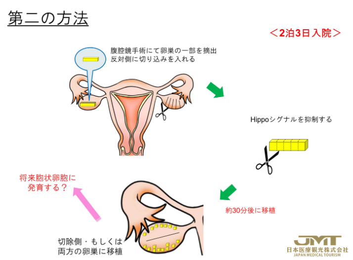 高龄及卵子老化造成的不孕不育的治疗②