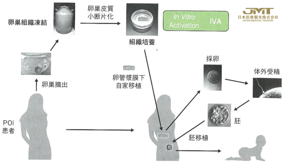 高龄及卵子老化造成的不孕不育的治疗②