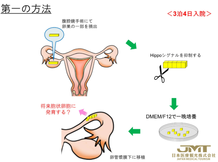 高龄及卵子老化造成的不孕不育的治疗②