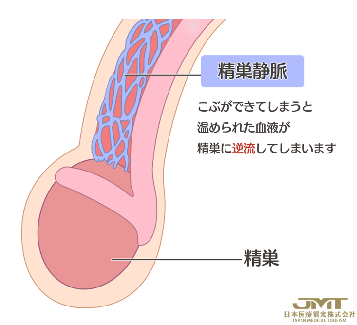 日本看病-男性怀疑不孕症时，主要原因有哪些？需要做什么样的检查？