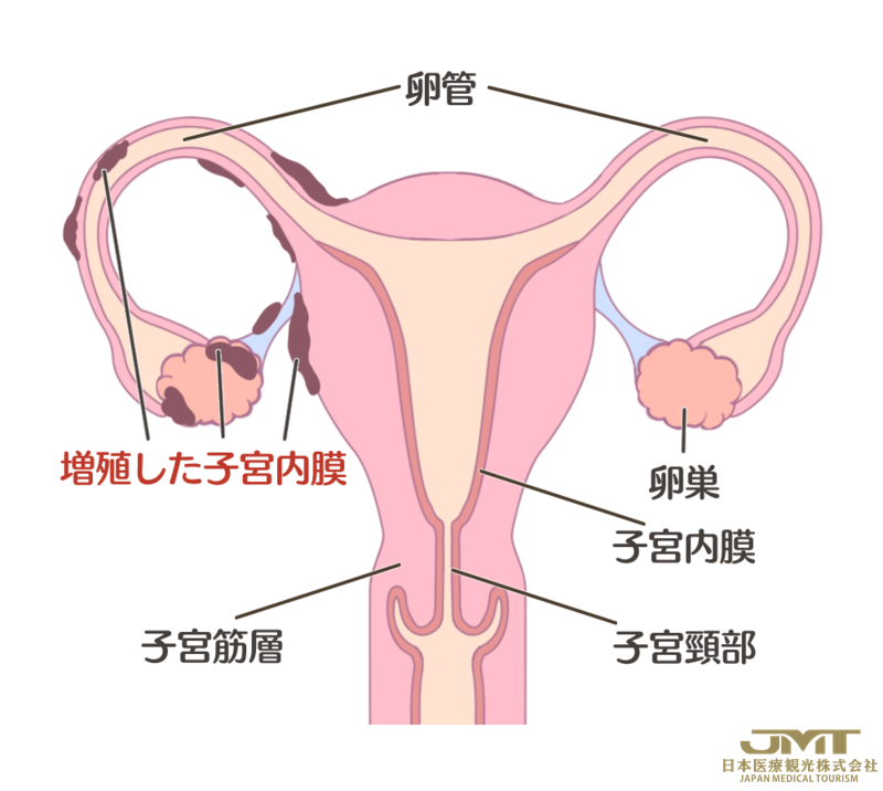 日本干细胞-什么是不孕症？女性患不孕症的主要原因有哪些？