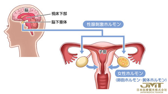 JMT日本医疗-浅谈不孕不育的定义及主要原因