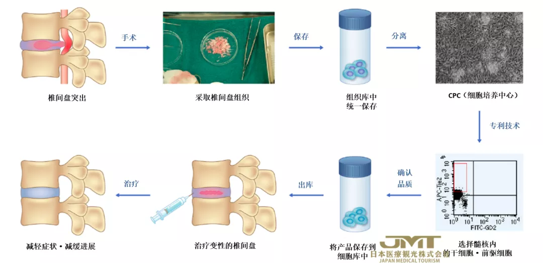 JMT日本医疗-腰痛的新型治疗方法—利用椎间盘的再生医疗技术进行治疗①