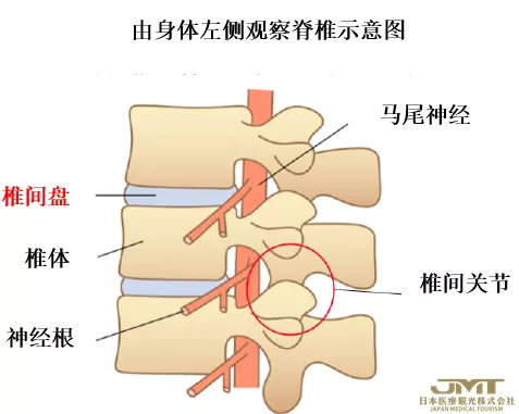 JMT日本医疗-腰痛的新型治疗方法—利用椎间盘的再生医疗技术进行治疗③