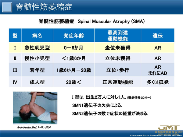 JMT日本医疗——“基因治疗”的前沿，对治疗帕金森病等顽固性神经系统疾病的期望越来越高③