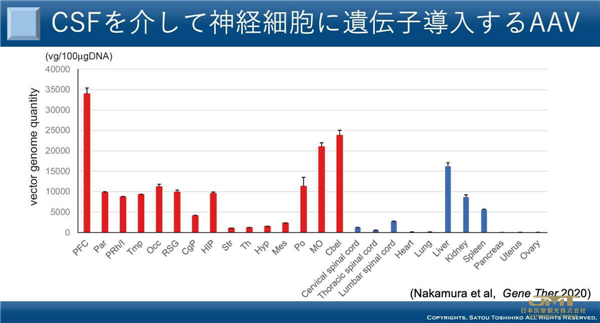 JMT日本医疗——“基因治疗”的前沿，对治疗帕金森病等顽固性神经系统疾病的期望越来越高⑤