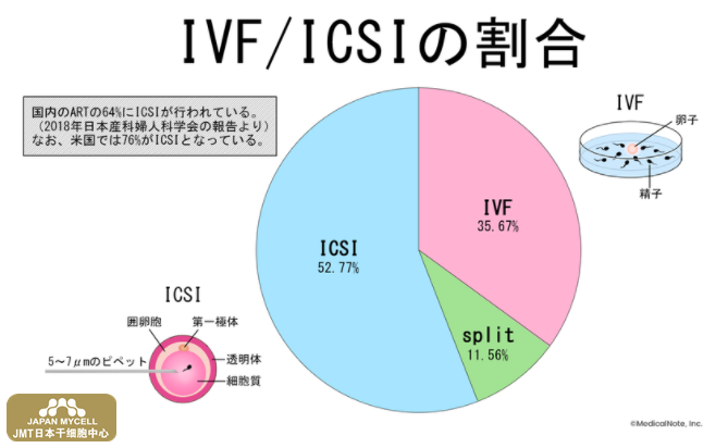 JMT日本干细胞中心-显微授精（ICSI）治疗不孕不育有哪些优势和风险？
