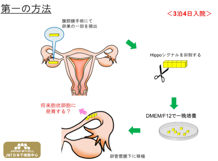 JMT日本干细胞中心-高龄及卵子老化造成不孕不育的治疗②