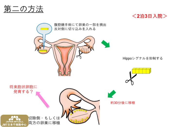 JMT日本干细胞中心-高龄及卵子老化造成不孕不育的治疗②
