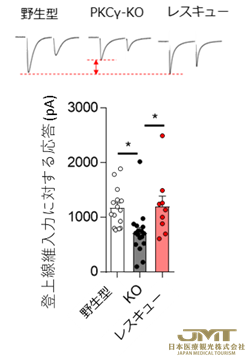 JMT日本医疗——阐明14型脊髓小脑失调症中运动失调发病的原因之一②