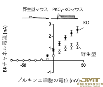 JMT日本医疗——阐明14型脊髓小脑失调症中运动失调发病的原因之一②