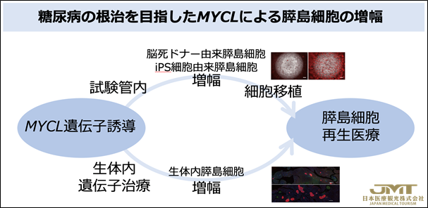 JMT日本医疗——成功增加成熟胰岛细胞-为根治糖尿病，公布了新的再生疗法的可能性③