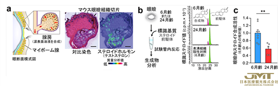 JMT日本医疗——使用新的内分泌机制治疗与年龄有关的眼部疾病，关键是局部激素和昼夜节律的衰老变化②