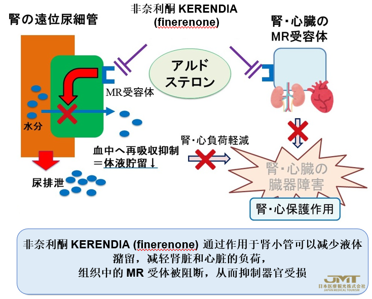 JMT日本医疗——2型糖尿病肾病新药非奈利酮KERENDIA (finerenone)在日本获批②
