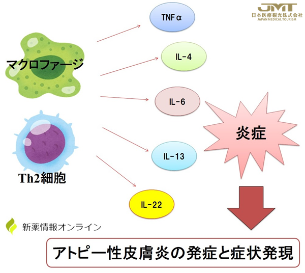 JMT日本医疗——特应性皮炎新药Cibinqo(abrocitinib)在日本获批