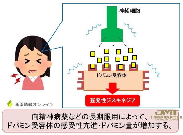 JMT日本医疗——缬苯那嗪Ingrezza(valbenazine)用于迟发性运动障碍在日本获批
