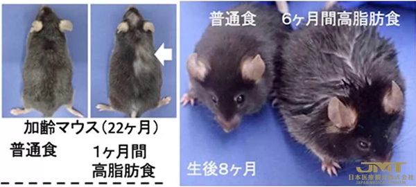 JMT日本医疗——东京医科齿科大学等证实中老年后肥胖会促进脱发和头发稀疏①