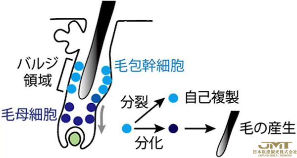JMT日本医疗——东京医科齿科大学等证实中老年后肥胖会促进脱发和头发稀疏①