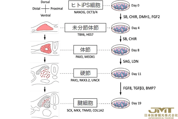 JMT日本医疗——京都大学开发利用iPS细胞来源肌腱细胞再生断裂肌腱的移植手术②