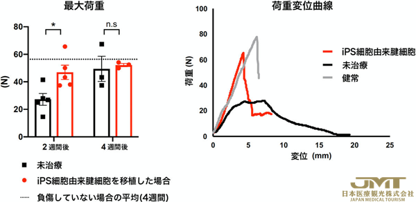 JMT日本医疗——京都大学开发利用iPS细胞来源肌腱细胞再生断裂肌腱的移植手术③
