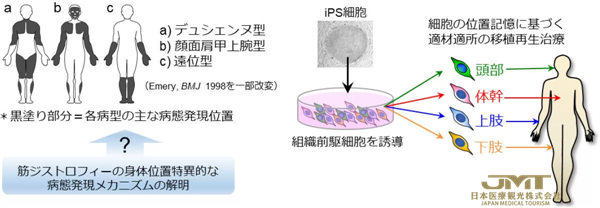 JMT日本医疗——熊本大学等发现“肌肉干细胞”的位置记忆是从胎儿时期就保留下来的②