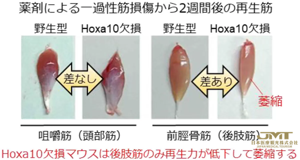 JMT日本医疗——熊本大学等发现“肌肉干细胞”的位置记忆是从胎儿时期就保留下来的②