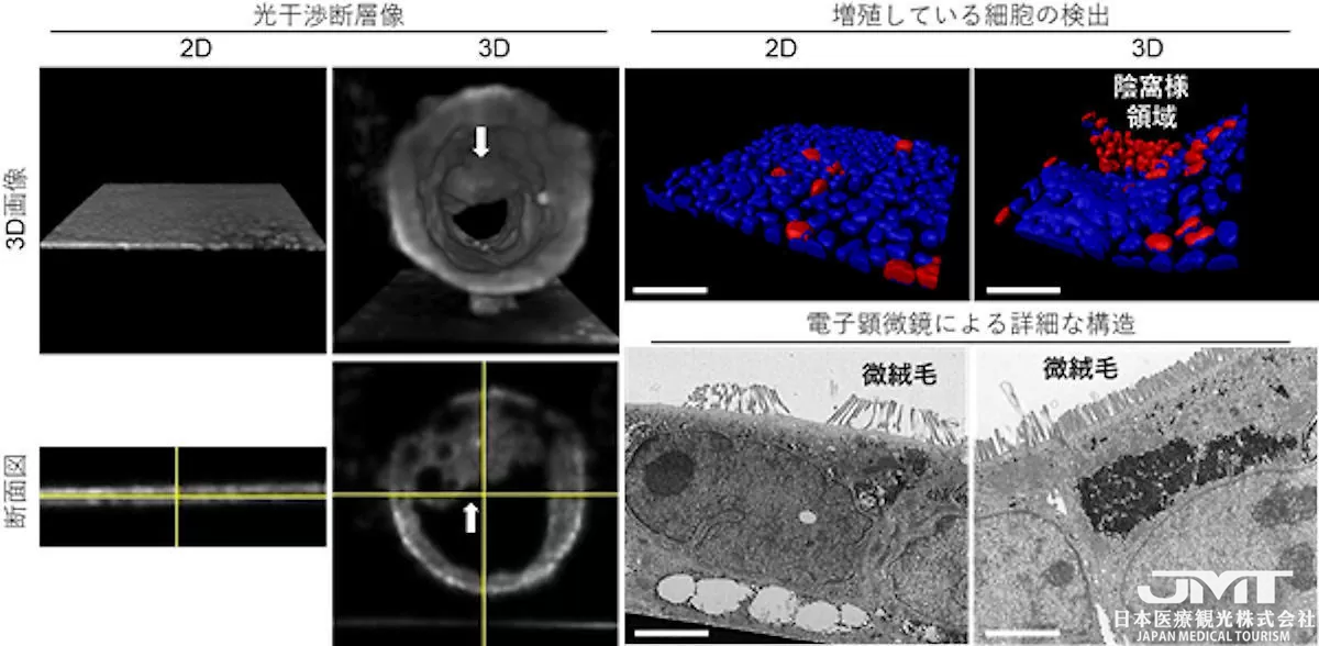 JMT日本医疗——东京大学生产技术研究所成功开发出具有3D结构的“3D肠道芯片”②