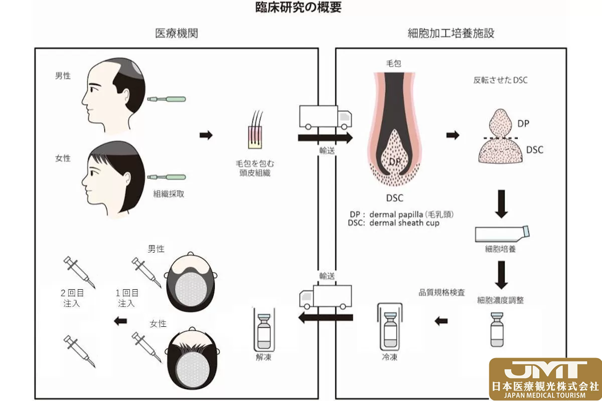 JMT日本医疗——东京医科大学等实施治疗普通脱发的再生医学临床试验