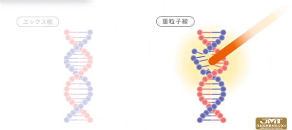 JMT日本医疗——简介QST医院及重离子线治疗①