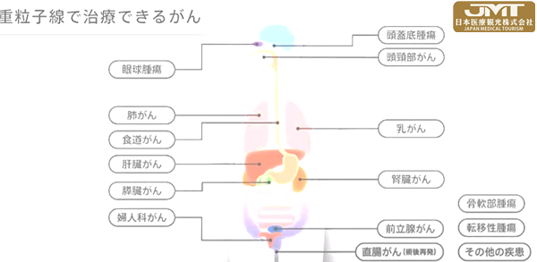 JMT日本医疗——简介QST医院及重离子线治疗①