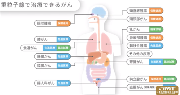 JMT日本医疗——简介QST医院及重离子线治疗①